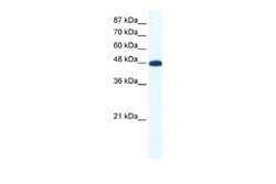 ACCN5 Rabbit anti-Human, Polyclonal, Novus Biologicals 0.1 mL | Buy Online | Novus Biologicals | Fisher Scientific